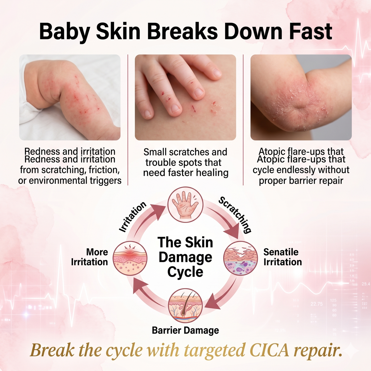 Mongdies Baby Cica Repair Cream 50g
