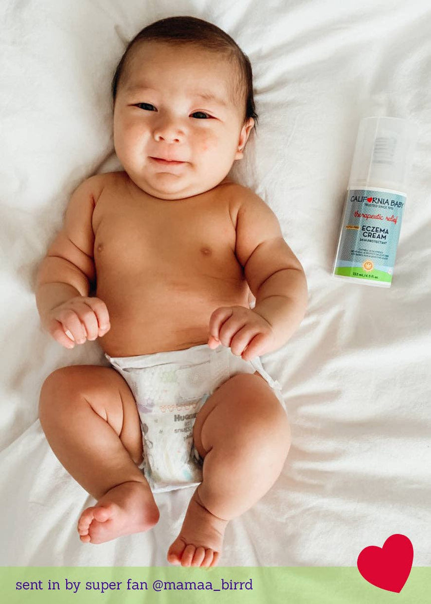 Eczema Cream: 2oz/57g - Princess and the Pea Boutique